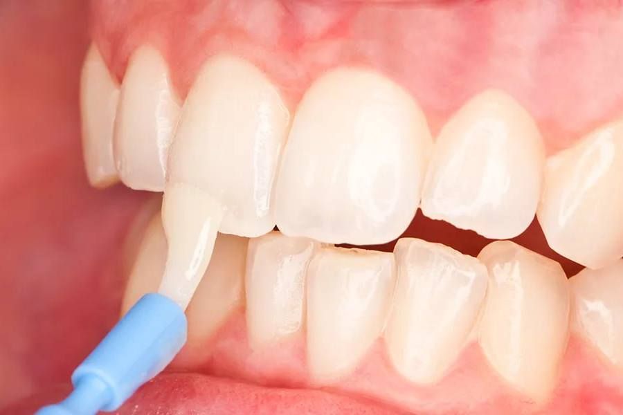 Тонкая работа стоматологов: как специалисты обточили зубы рыбе-фугу, спасая её от голодной смерти