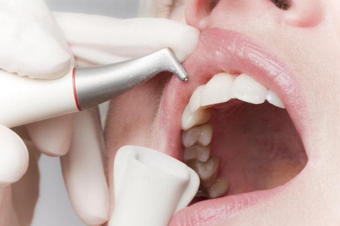 Причины повреждения зубов у детей
